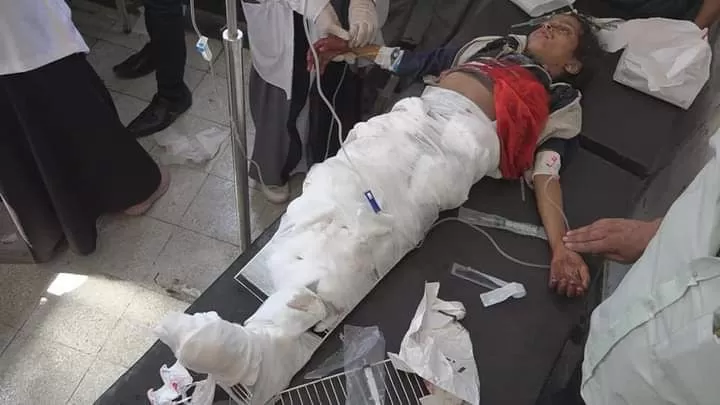 تقرير أممي يفضح الحوثيين بقتل المدنيين والأطفال.. جرائم حرب لا تسقط بالتقادم